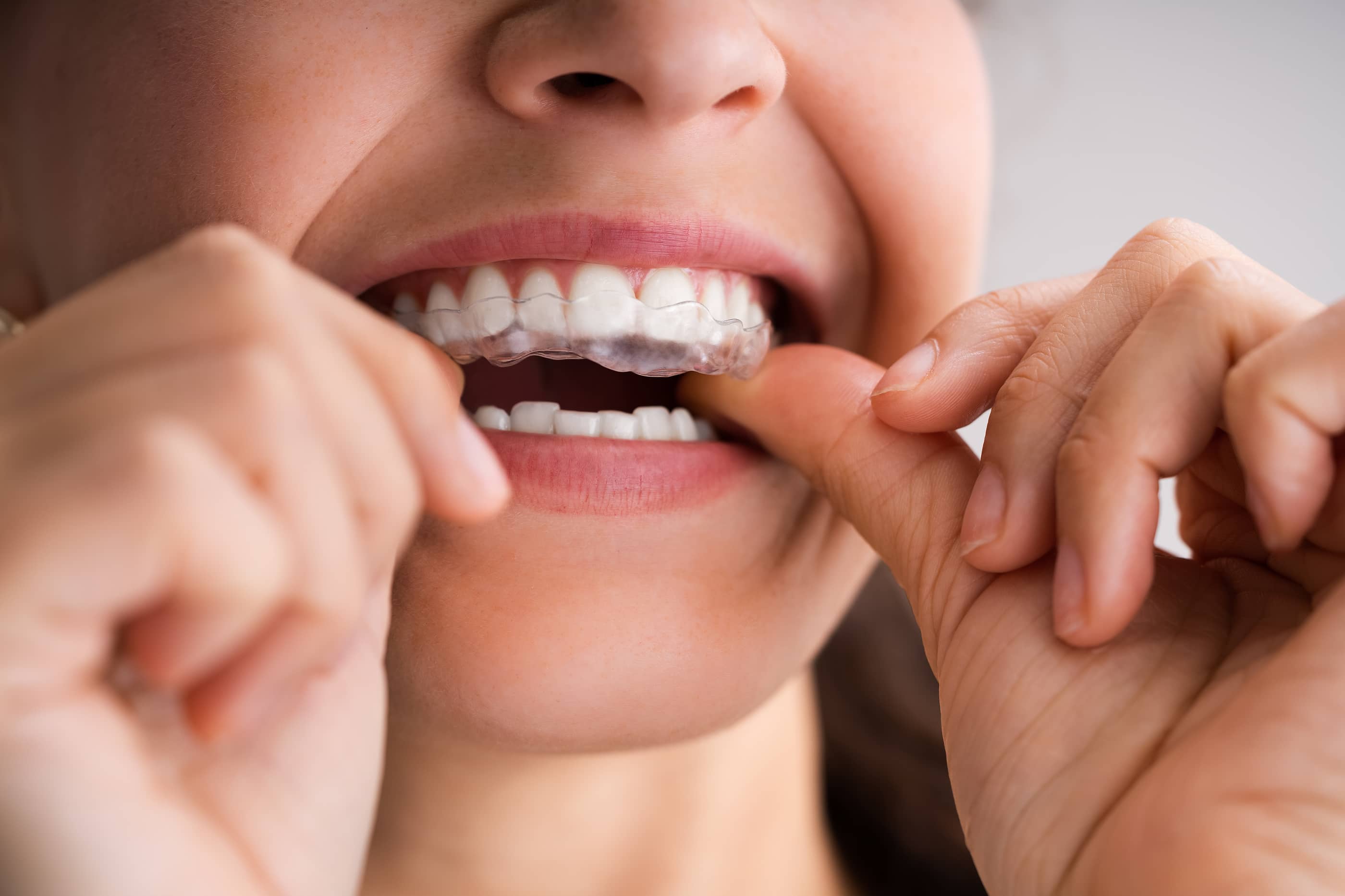 Periodontics service Image Periodontics service Image